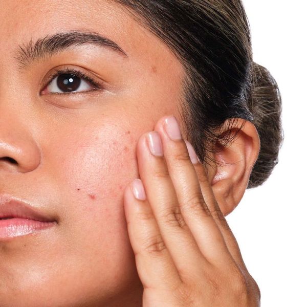 Solution Acide Salicylique - 30ml