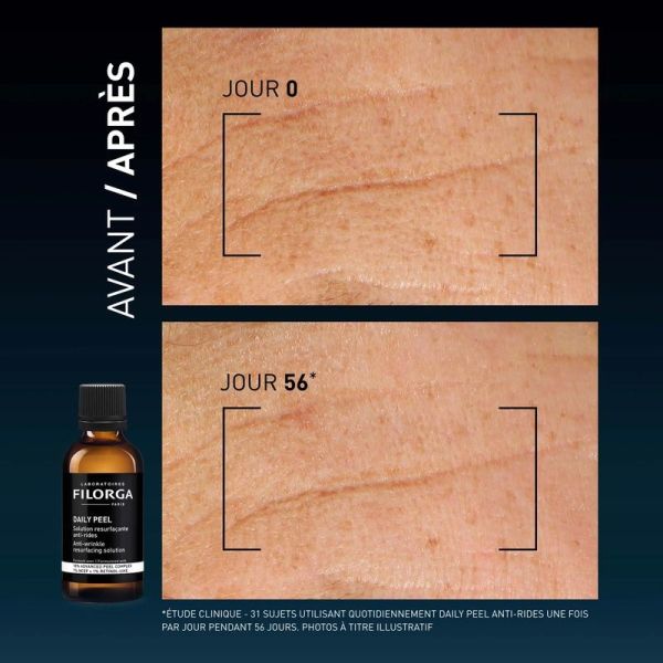 DAILY PEEL [Anti-rides] - 50 ml