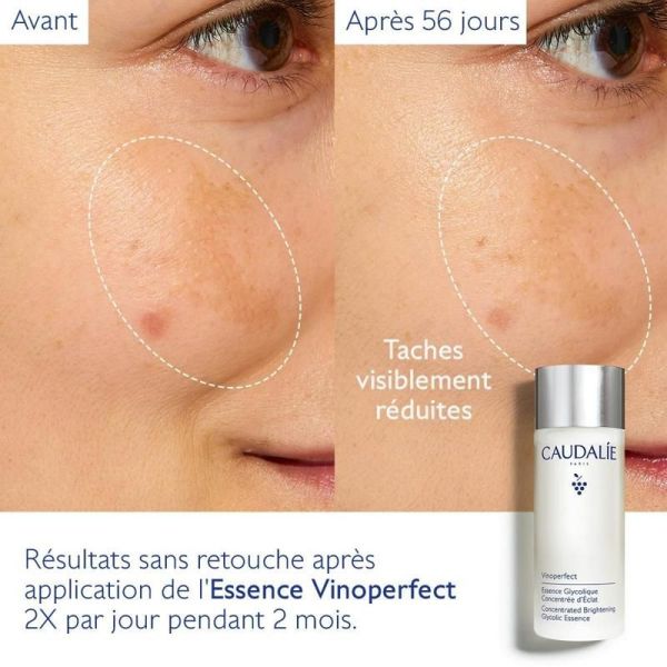 Vinoperfect Essence Glycolique Concentrée d'Éclat - 100mL