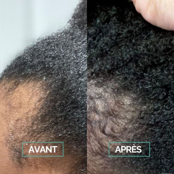 Sérum Boost & Scalp - 50ml