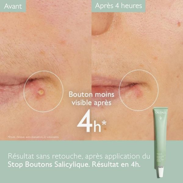 Vinopure Stop Boutons à l'Acide Salicylique