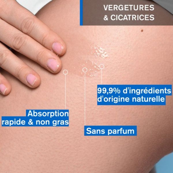 Prévention des vergetures-Bariederm-Cica Huile Dermatologique - 100 mL