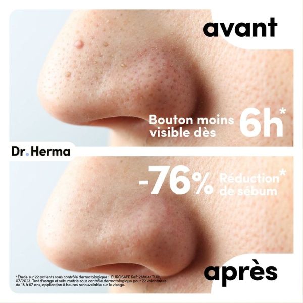 Patch Anti-Bouton - Nez