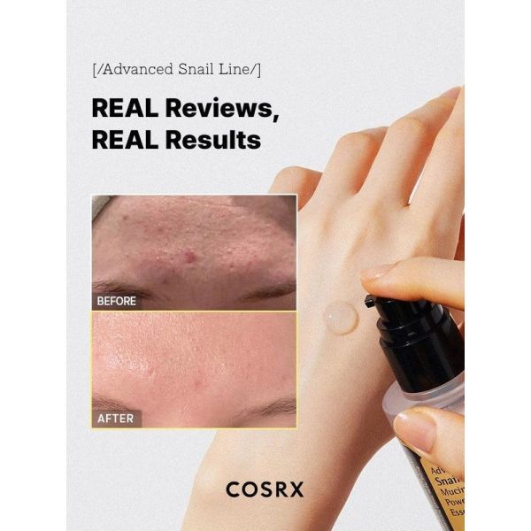 Advanced Snail 96 Mucin Power Essence - 100 ml