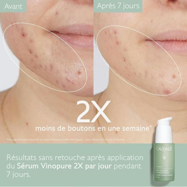 Vinopure Sérum à l'Acide Salicylique Anti-imperfections