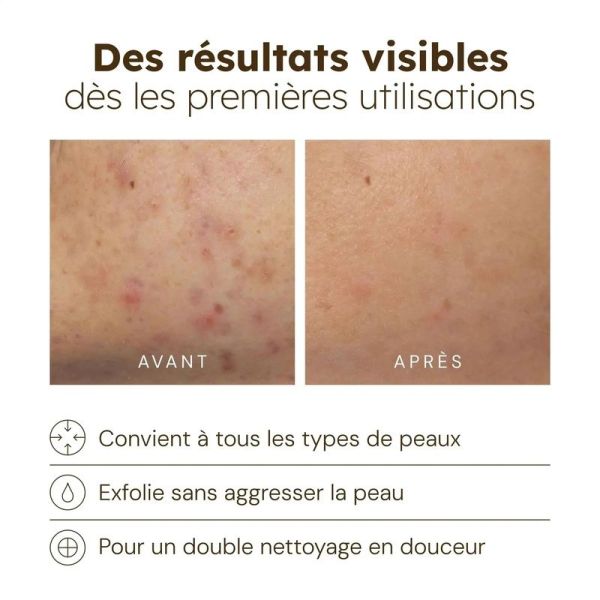 Nettoyant Éclat au Curcuma - 100 ml