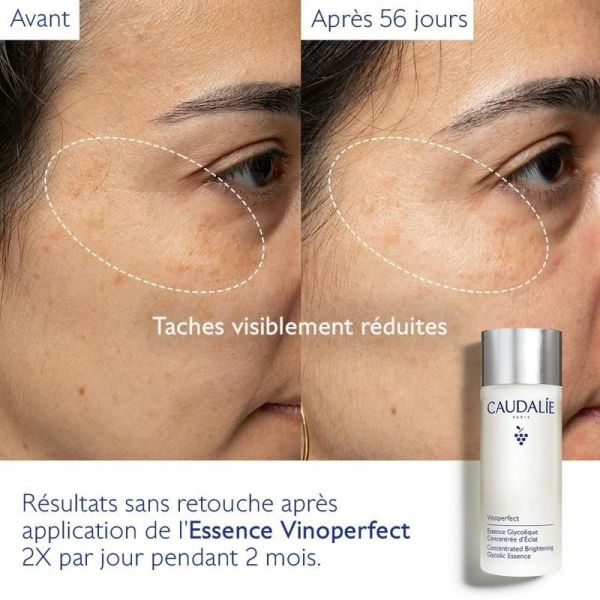 Vinoperfect Essence Glycolique Concentrée d'Éclat - 100mL