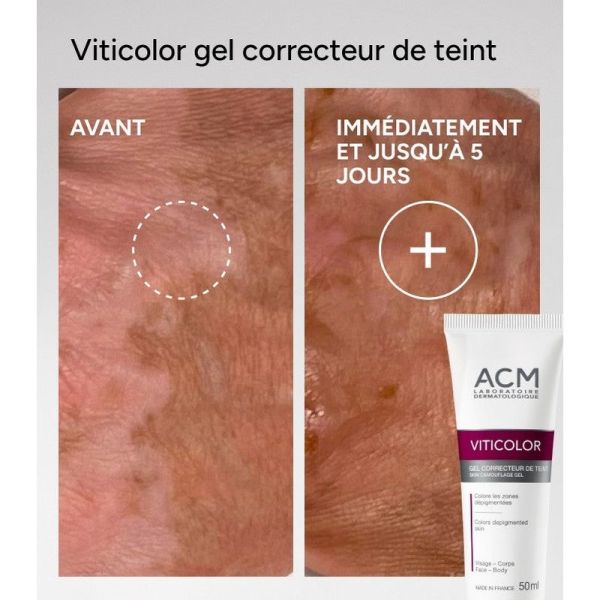 Gel Correcteur De Teint - 50 ml